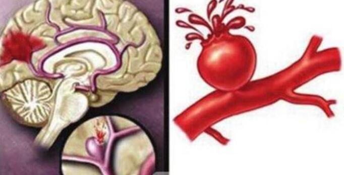 经常吃橘子有什么好处,女性养颜护肤佳品